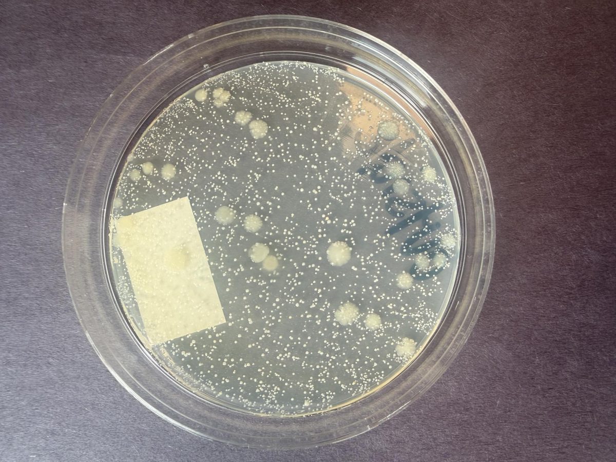 Dangers of Vaping Confirmed by Science Teacher Bacteria Swab